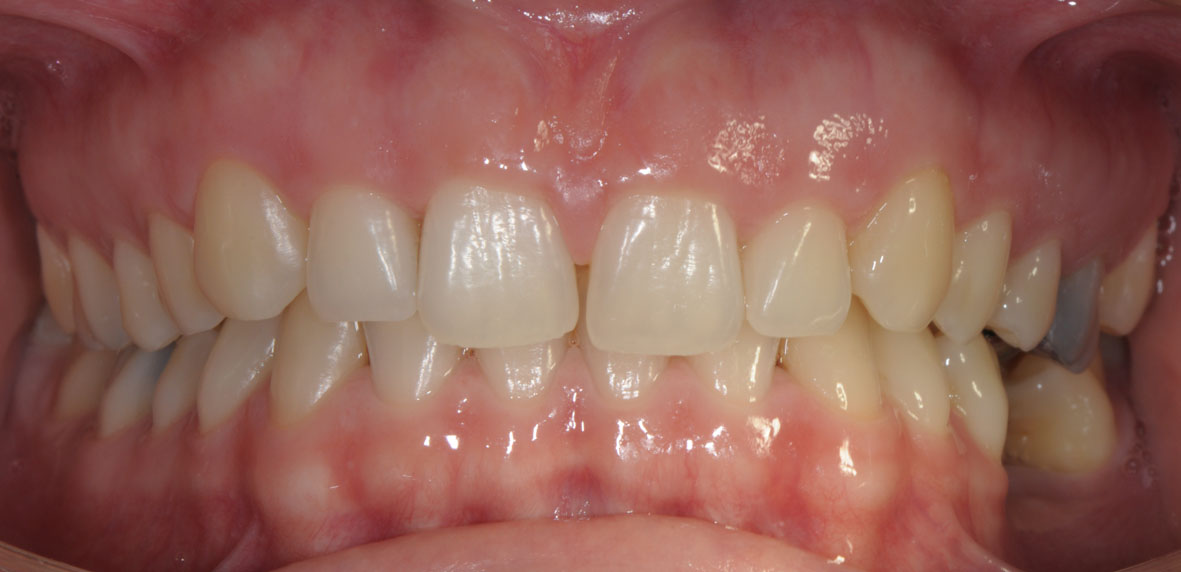 ortodonzia allienatori